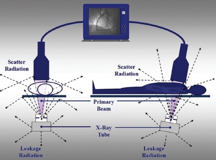 radiation safety model