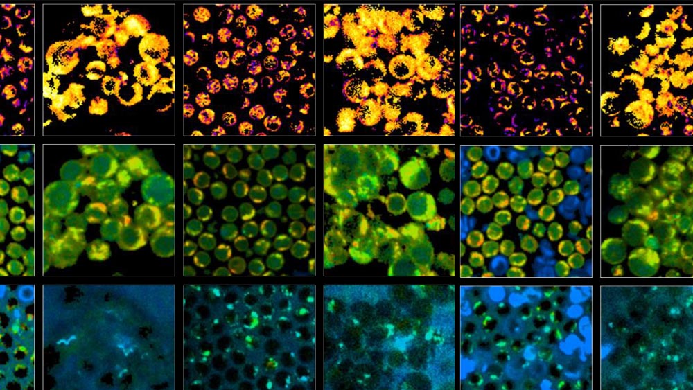 Panel T cells