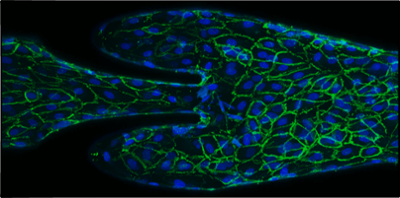 Microscopic view of the vascular cells in blue and green.