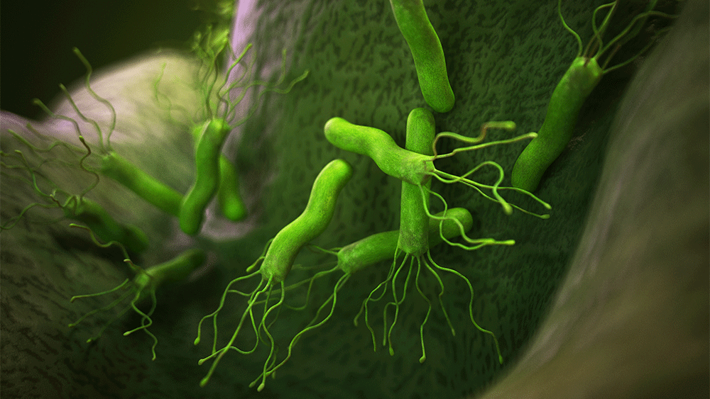 H. Pylori in a stomach 