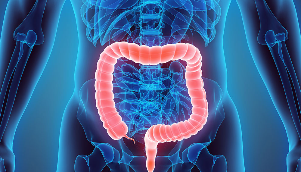 Graphic of large intestine