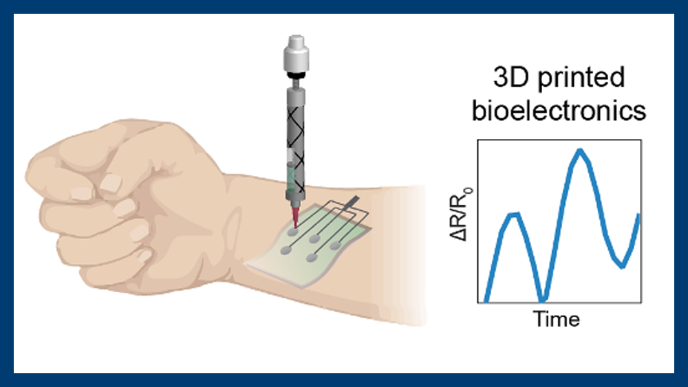 Drawing of a forearm with a 3D-printable device. Graph to the right of the arm shows dynamic motion capture through resistance change measurement.