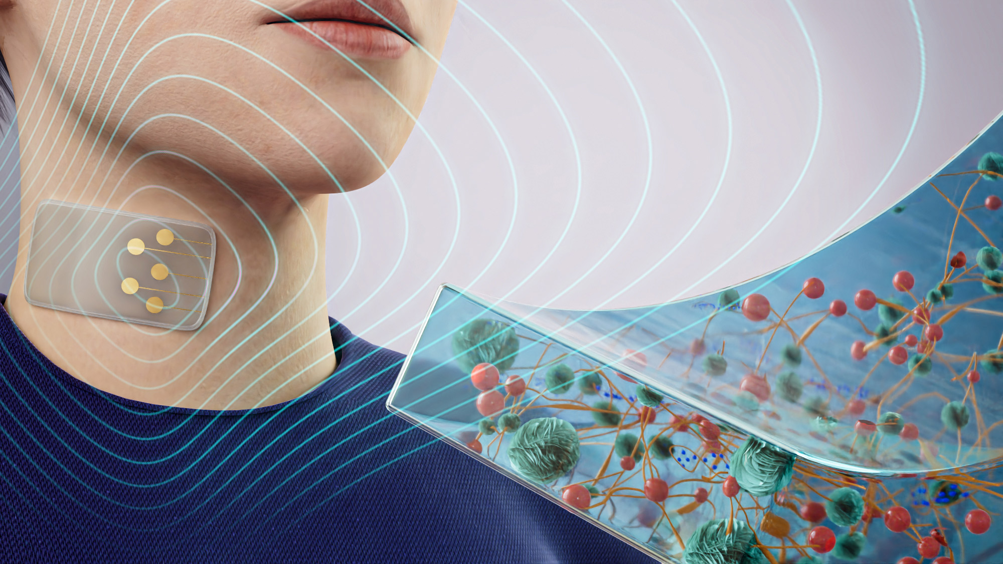  A patch of electronic skin on a human neck with a diagram of the nanoengineered hydrogels