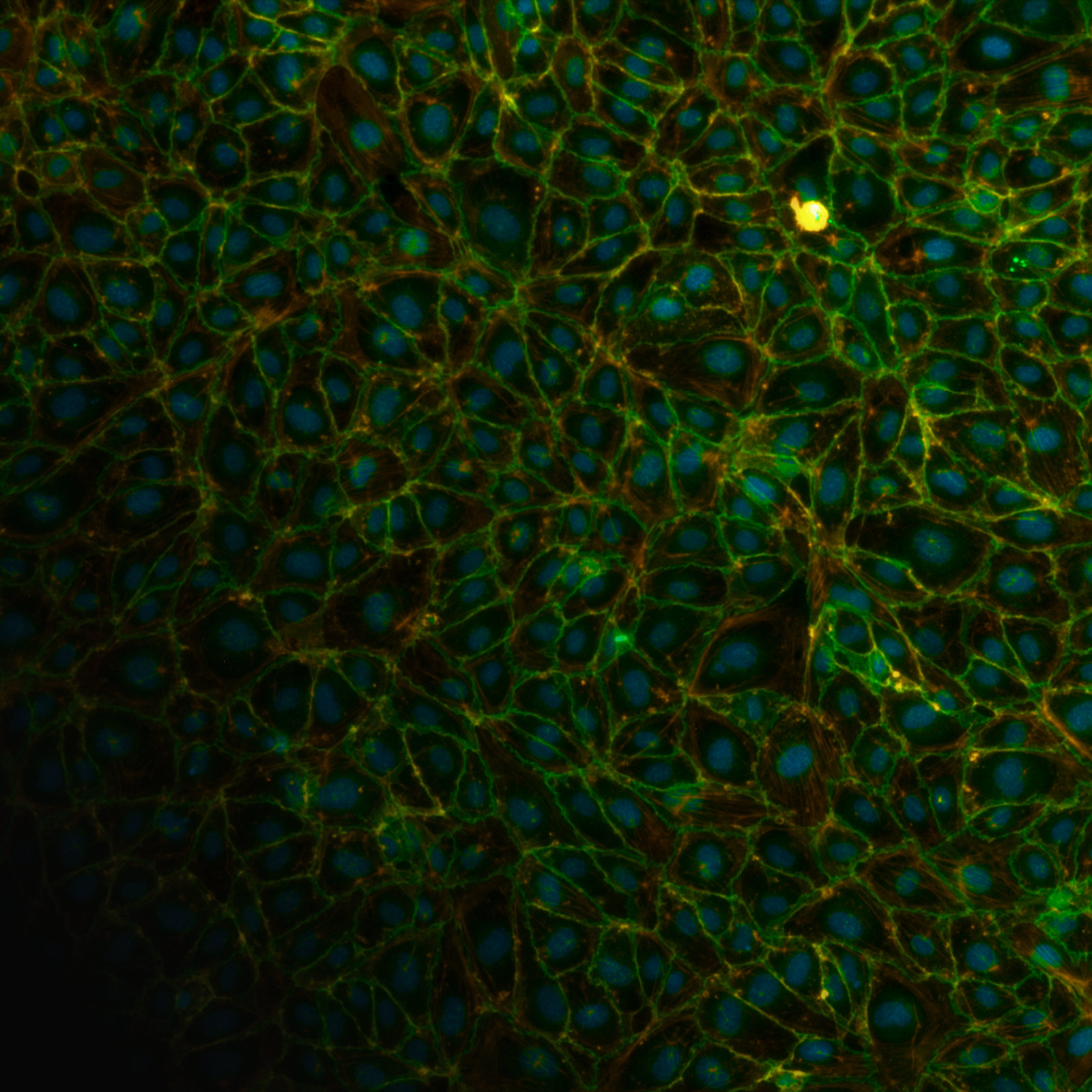 A field of cells with blue nuclei, creating a web-like structure.